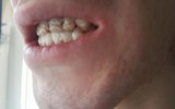 [ẢNH] Tác hại khôn lường khi uống quá nhiều nước tăng lực